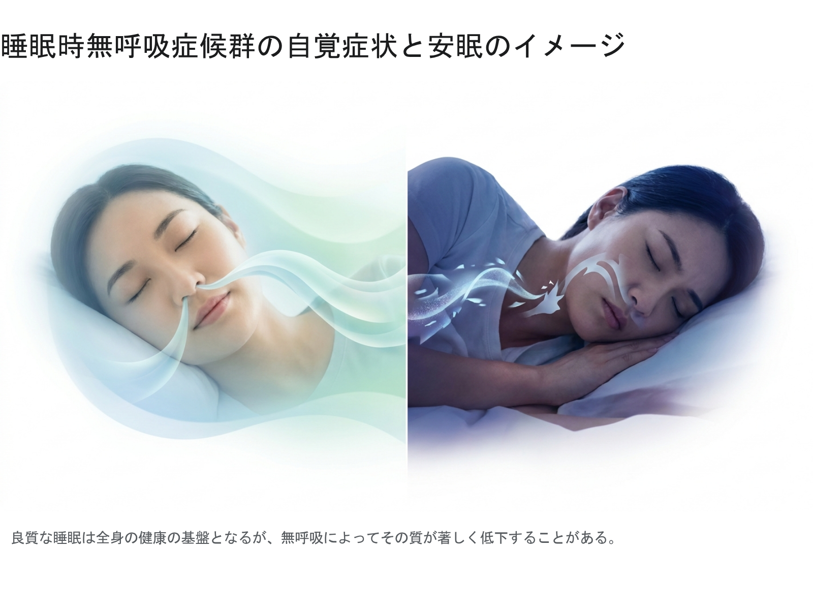 図1 睡眠時無呼吸症候群の自覚症状と安眠のイメージ