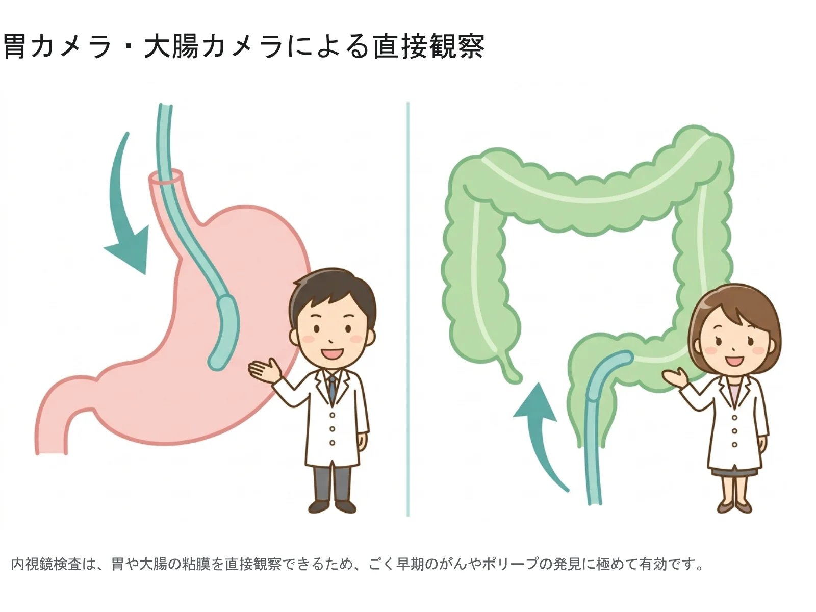 図3：胃カメラ・大腸カメラによる内視鏡検査のイラスト