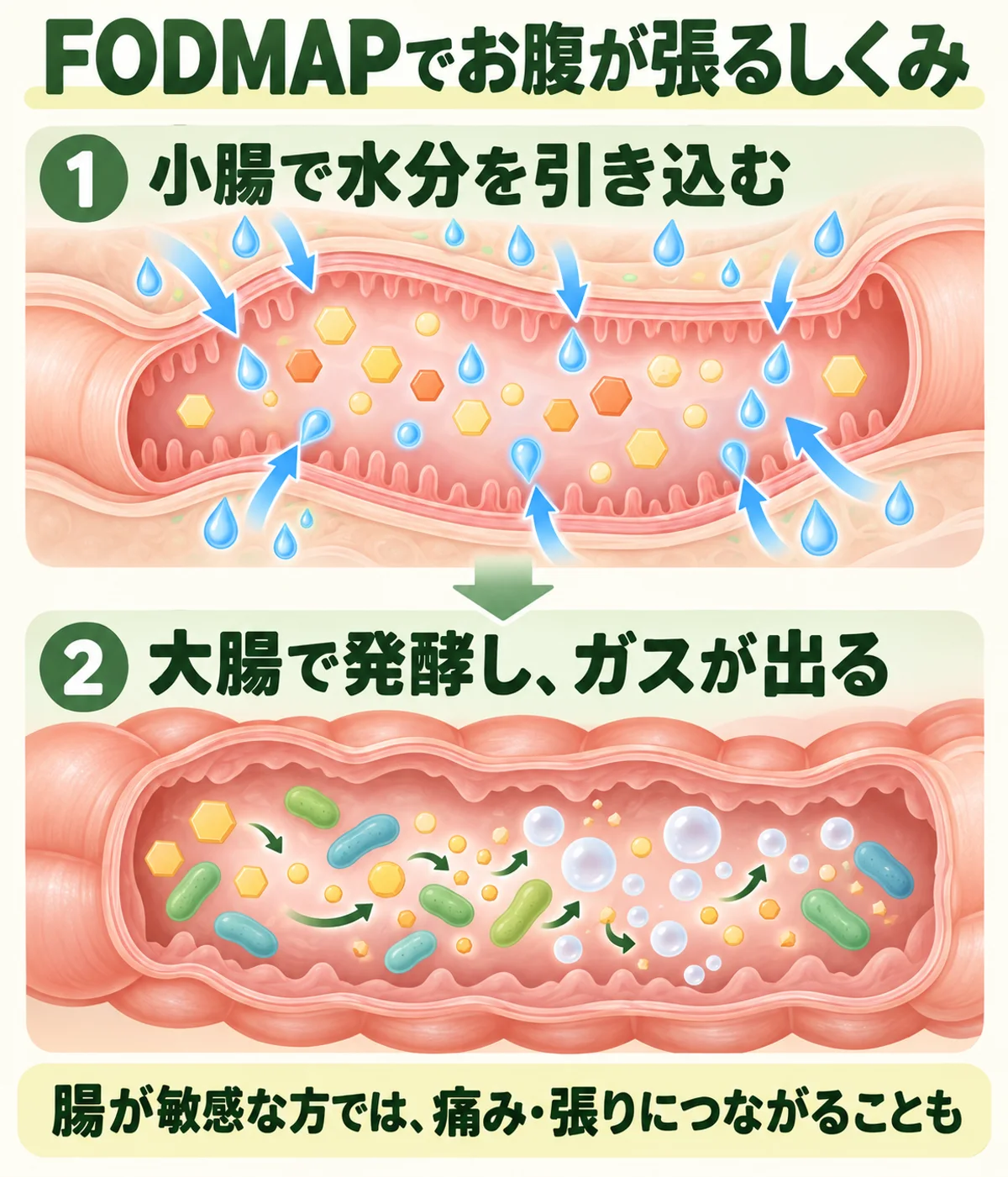 小腸で吸収されにくい糖質が水分を引き込み、大腸で細菌に発酵されてガスが生じるFODMAPの概念図